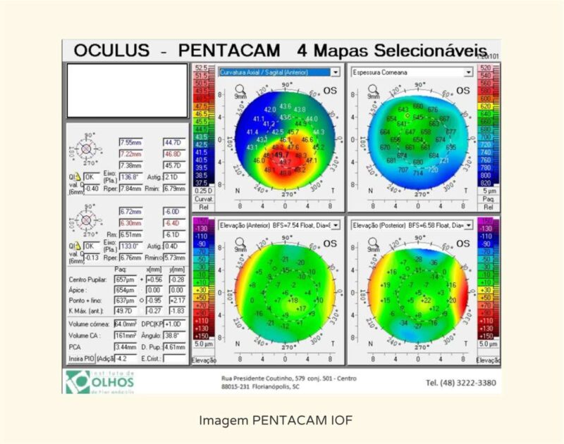 Pentacam - Instituto de Olhos de Florianópolis